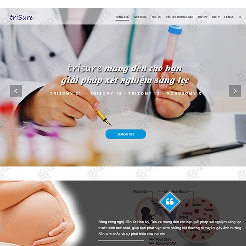 Hình ảnh của Thiết kế website Trisure